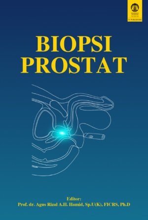 Biopsi Prostat