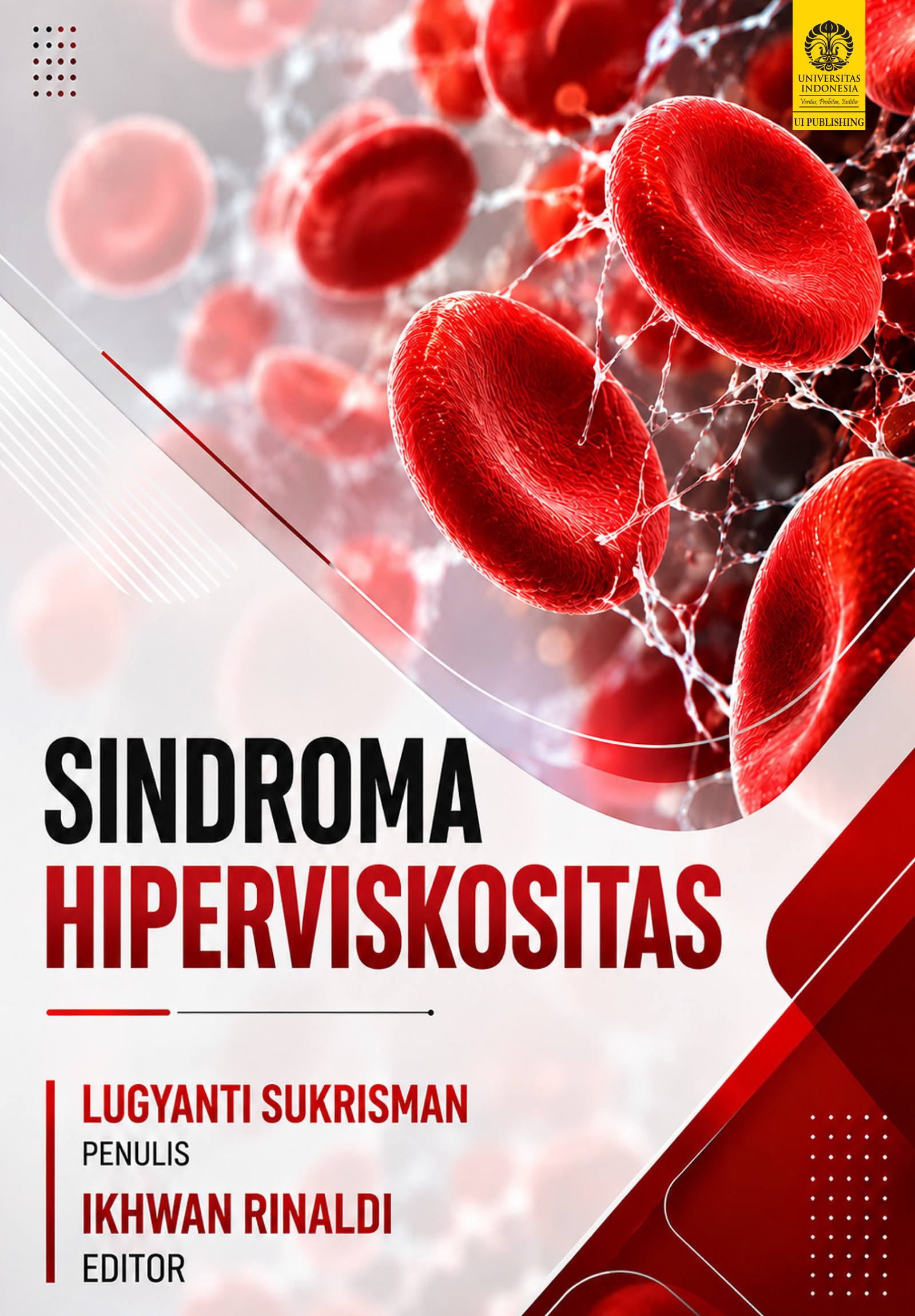 Sindroma Hiperviskositas